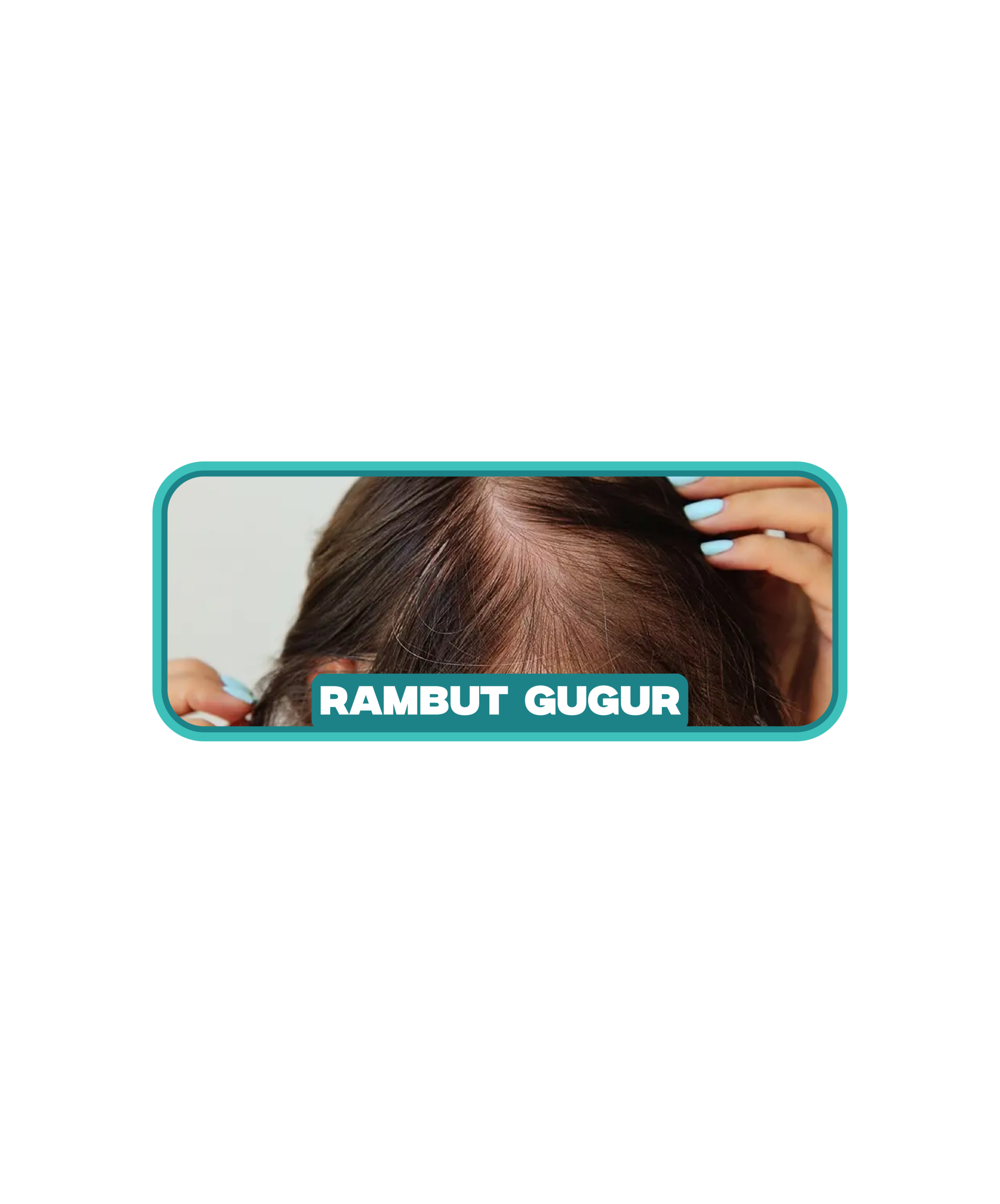 Masalah rambut gugur