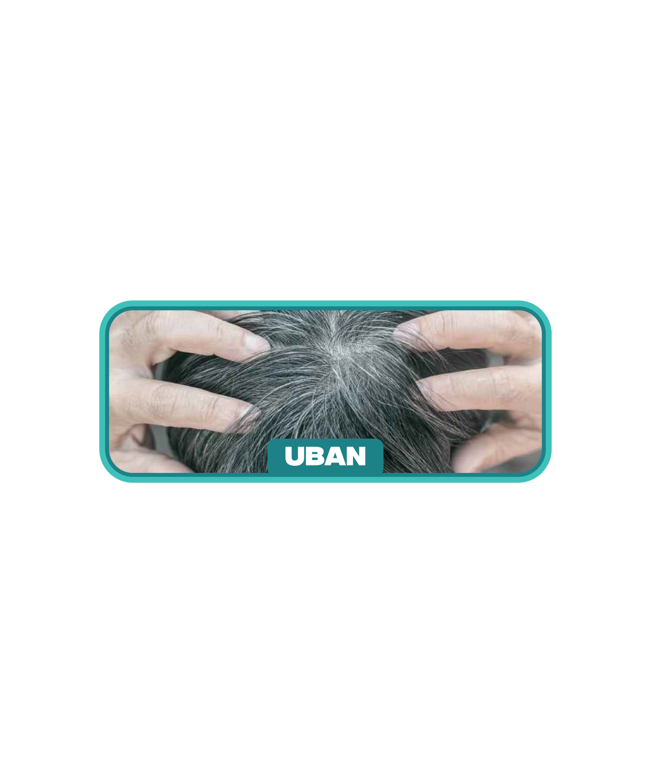 Masalah uban