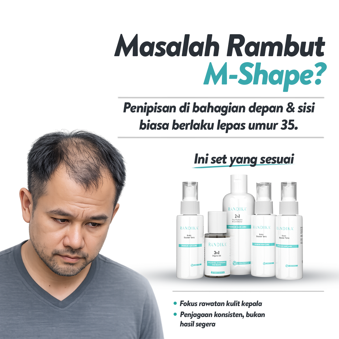 Masalah botak M-Shape dan rambut menipis