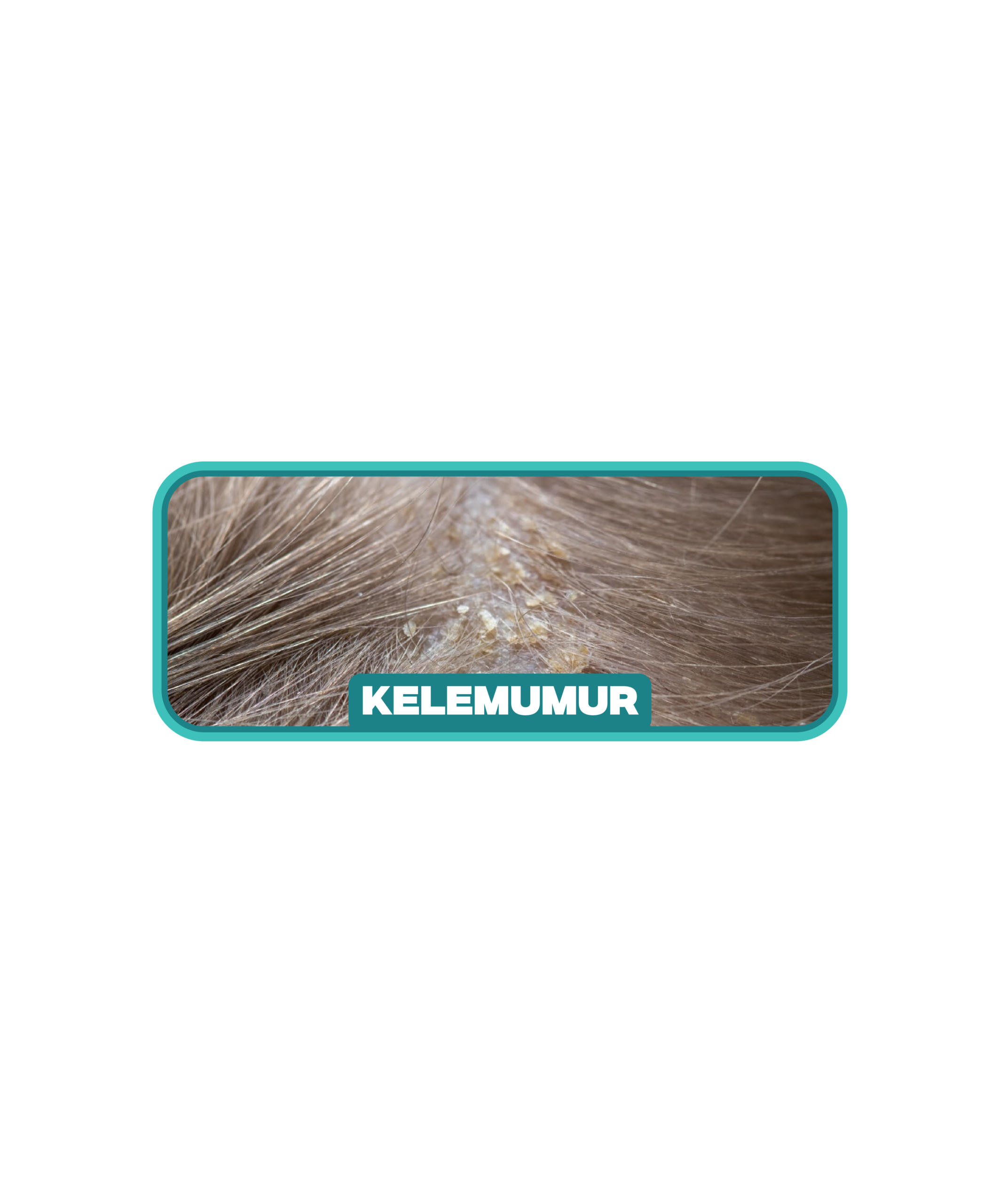 Masalah kelemumur